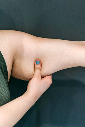 cellulite aqueuse